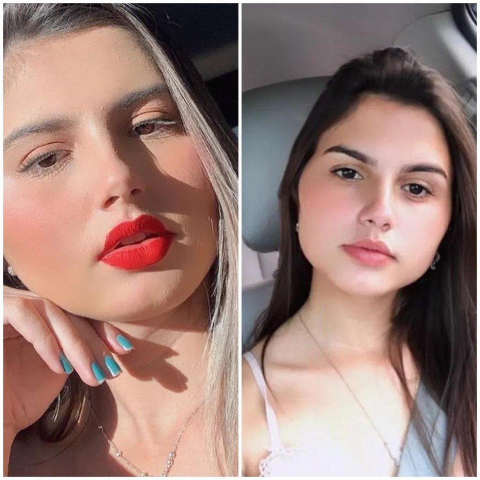 Gêmeas que passaram por cirurgia de readequação de sexo em SC têm liberação médica e voltam para casa