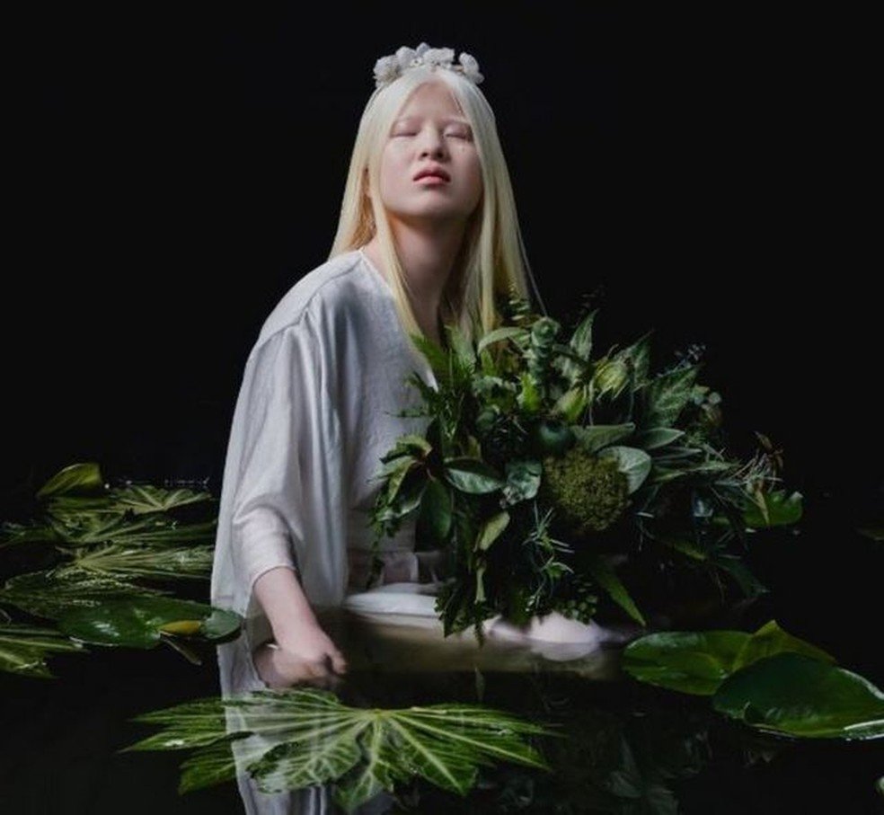 Chinesa albina abandonada ainda bebê que se tornou modelo da Vogue