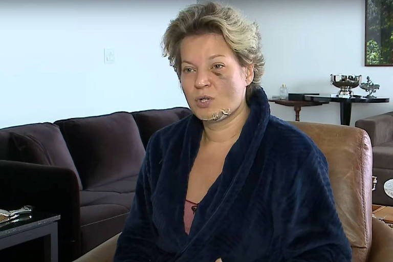 Joice Hasselmann acorda com fraturas no rosto, no corpo e sangue no chão mas não lembra de nada. Policia investiga o fato.