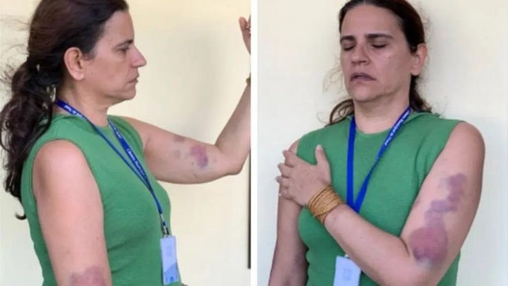 Jornalista acusa ex-chefe de agressão. O acusado se defende e diz que a vítima é ele