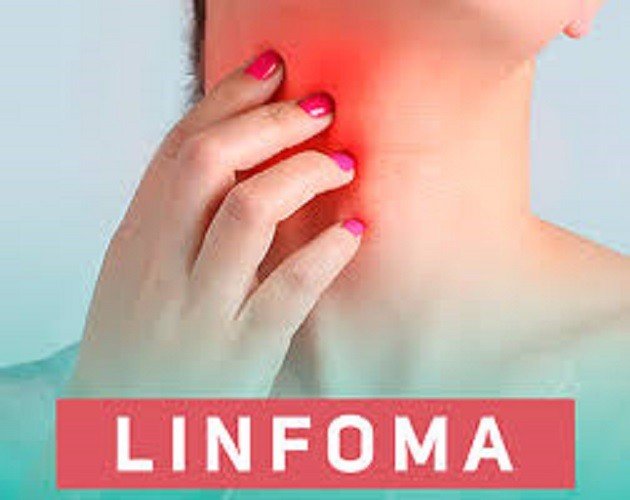 15 de setembro é o Dia Mundial da Conscientização sobre linfomas