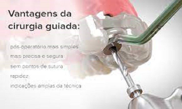 Saiba como funciona a cirurgia de implantes dentários sem cortes