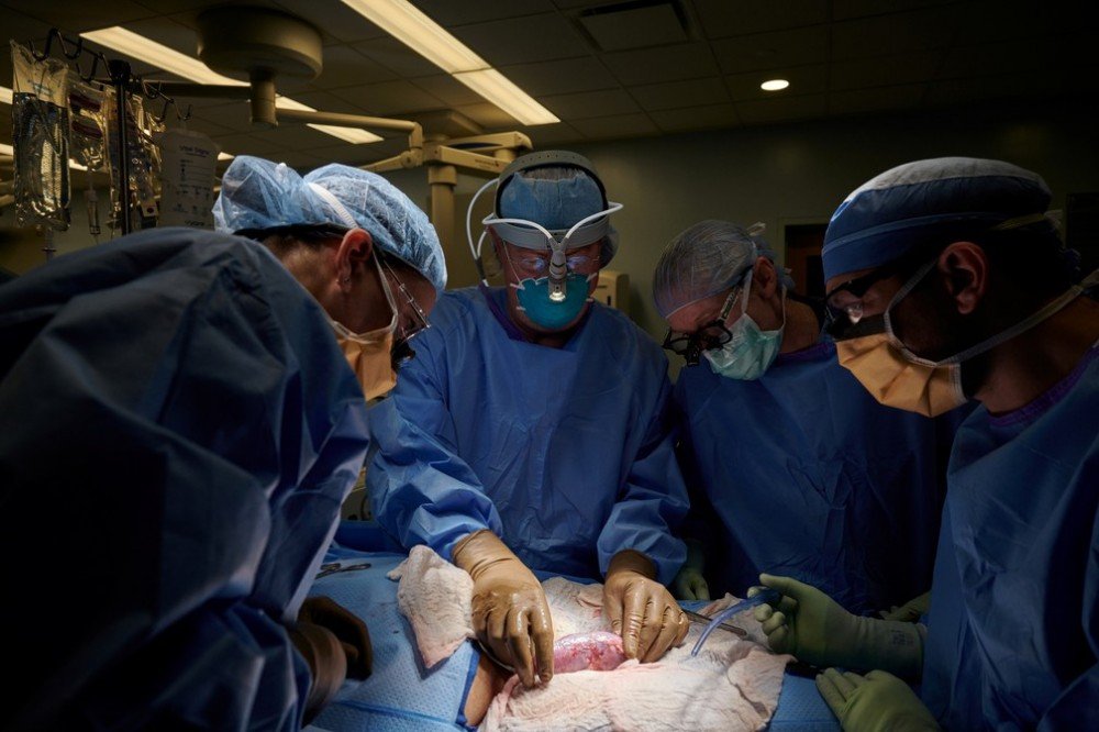 Cirurgiões dos EUA testam com sucesso transplante de rim de porco em humano