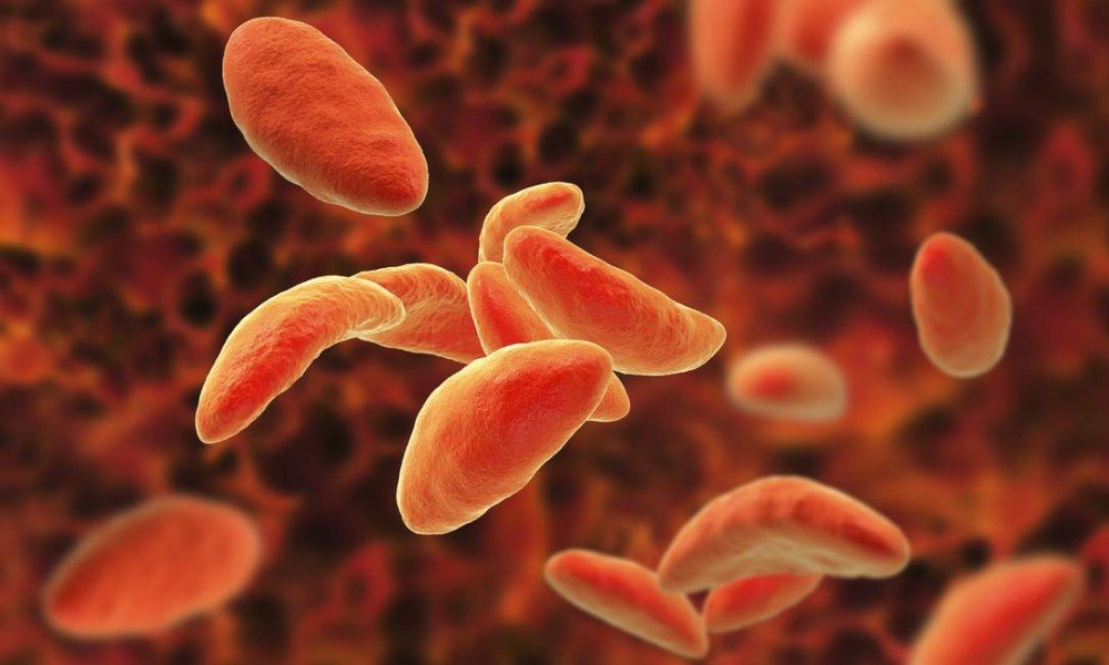 Parasita da toxoplasmose pode ajudar no tratamento do câncer