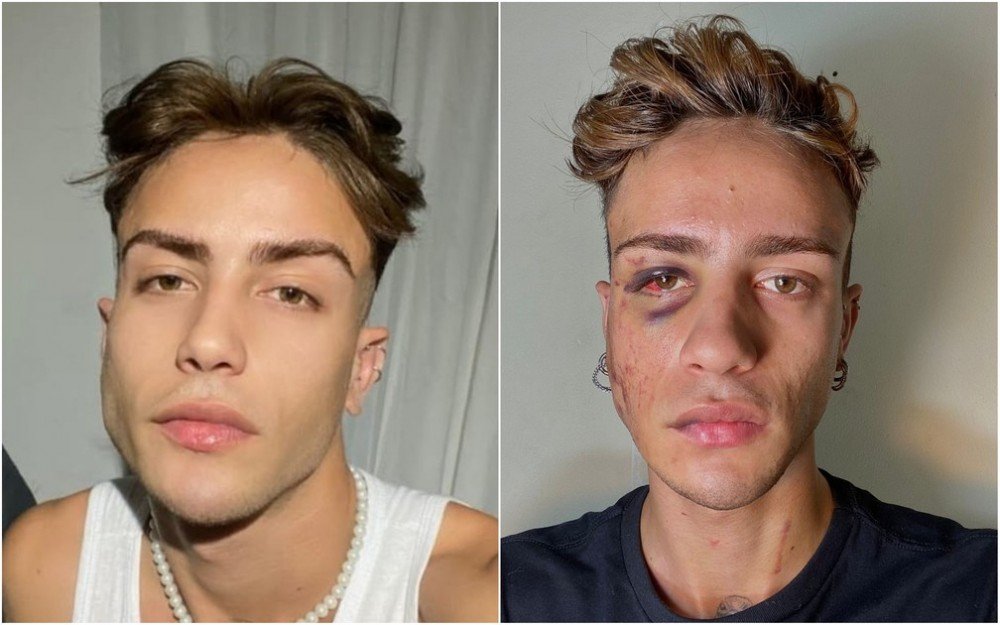 Jovem diz ter sido agredido por médico durante convulsão em hospital