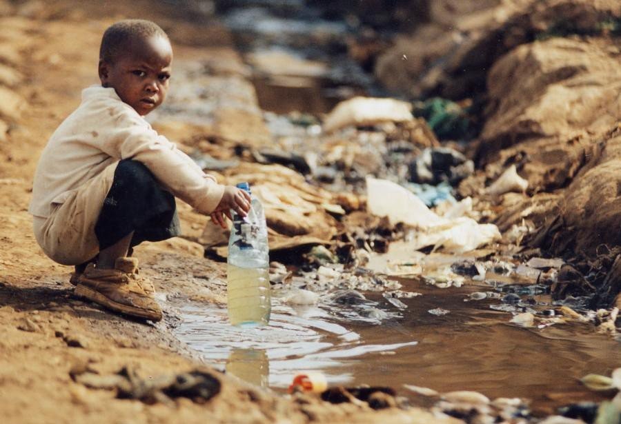 Criança de 3 anos, que reclamava de tosse persistente, tinha sanguessuga na garganta
