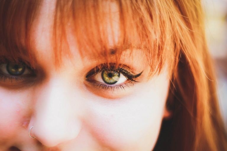 5 Dicas fáceis para diminuir as olheiras