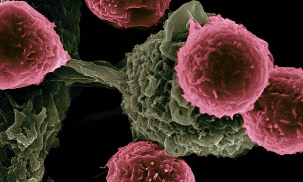 Câncer: ciência explica por que os homens apresentam quadros mais agressivos