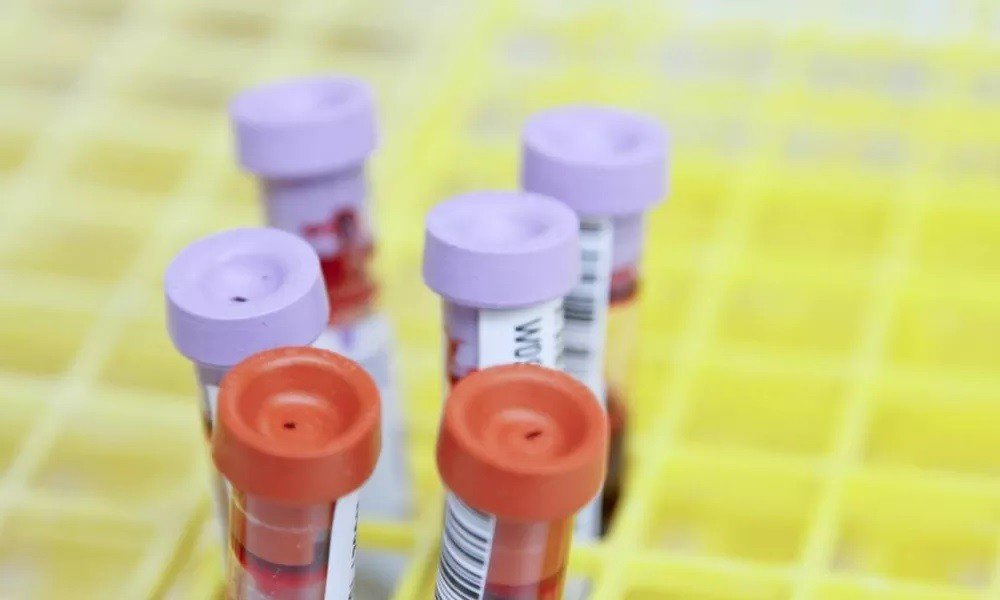 Ministério da Saúde monitora sete casos suspeitos de hepatite em crianças