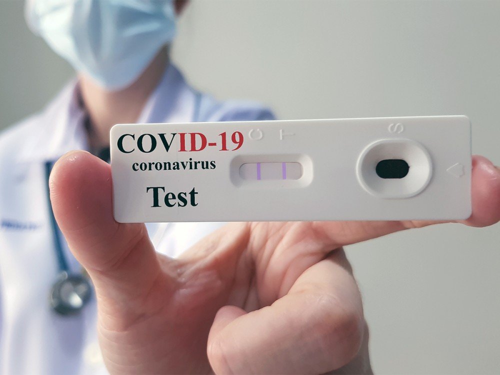 Testes positivos de Covid-19 sobem de 8,4% para 13% em três semanas, apontam dados de laboratórios