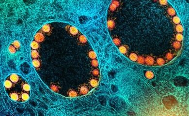 Fiocruz identifica 25 casos da variante XQ no Rio Grande do Sul