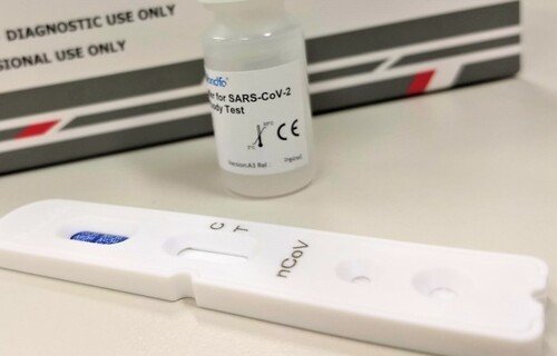 Covid-19: crescem buscas sobre 