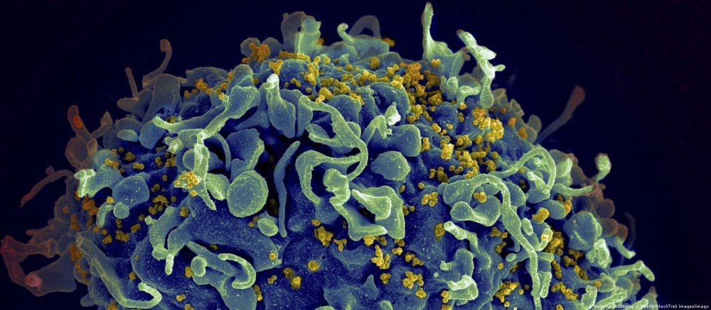 Médicos anunciam quarto caso de cura do HIV