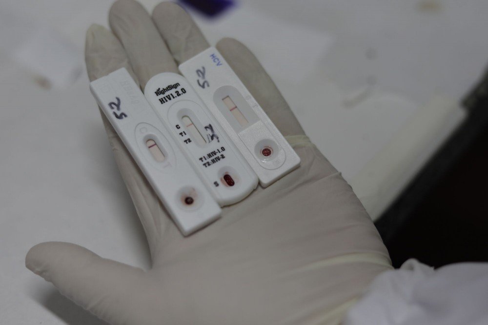 Redução de verba para tratamento do HIV afeta pacientes na Bahia