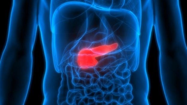 Por que câncer de pâncreas entrou para a lista dos que mais matam no Brasil