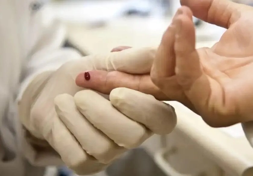 Bahia registra mais de 2 mil casos de infecção por vírus HIV em 2023