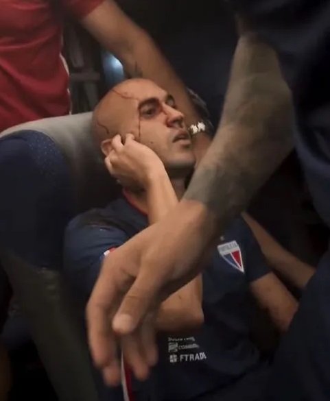 Ataque teria partido de uma torcida organizada do Sport - Foto: Reprodução | Redes Sociais