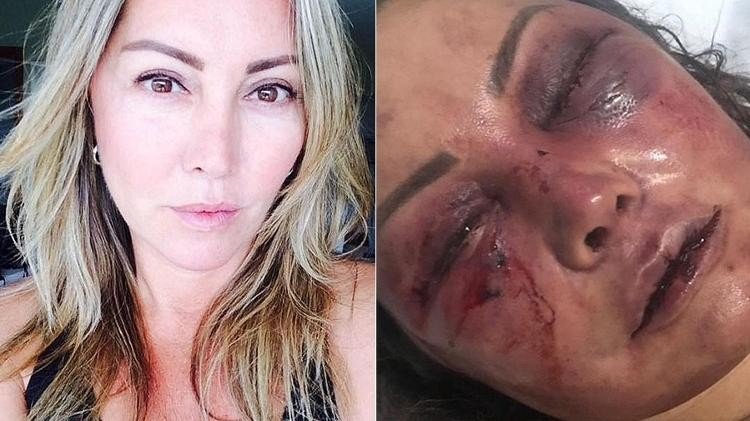 Justiça decreta prisão preventiva de agressor de empresária espancada no RJ