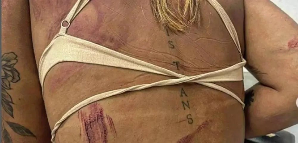 Trans, assessora de vereadora de Niterói é agredida em bar no Rio