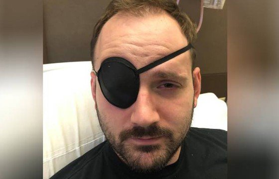 Com tensão muscular, homem alonga pescoço e sofre AVC
