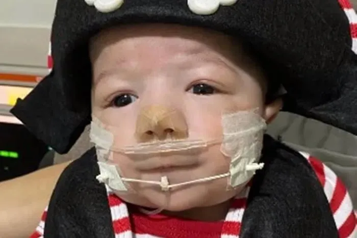 O que é a Síndrome de Patau, doença que vitimou o filho de Zé Vaqueiro?