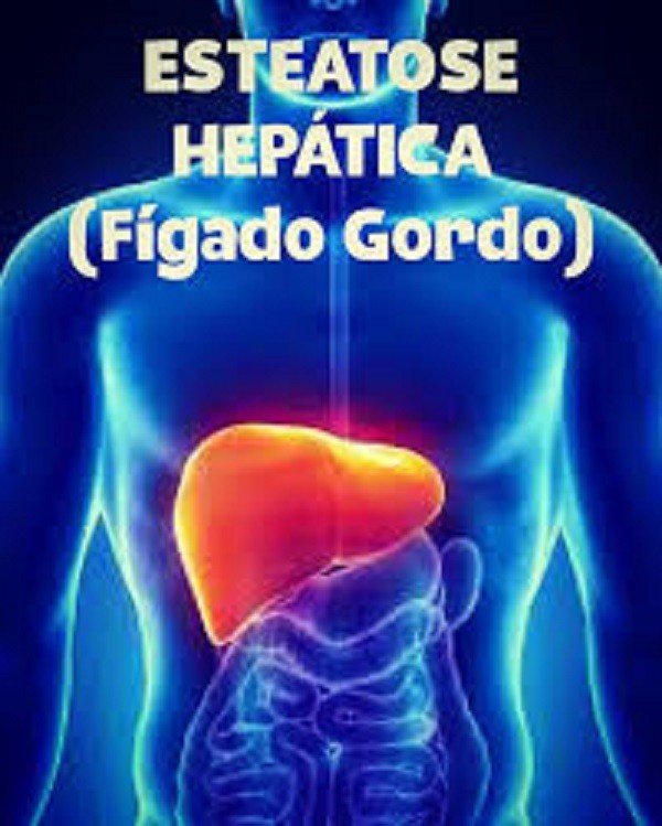 Esteatose hepática; conheça mais sobre essa doença perigosa