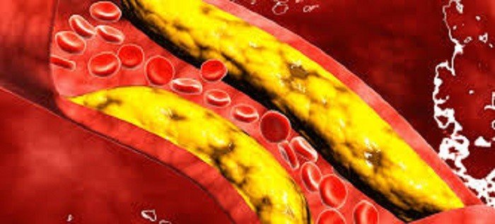 Níveis ideais de colesterol no sangue variam de acordo com grau de risco do paciente para doenças cardiovasculares