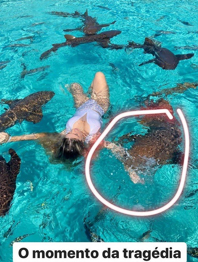 Influencer é mordida por tubarão nas Bahamas: 'Arrancou um pedaço do meu braço'