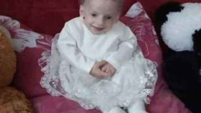 Menina com doença rara morre de velhice aos oito anos