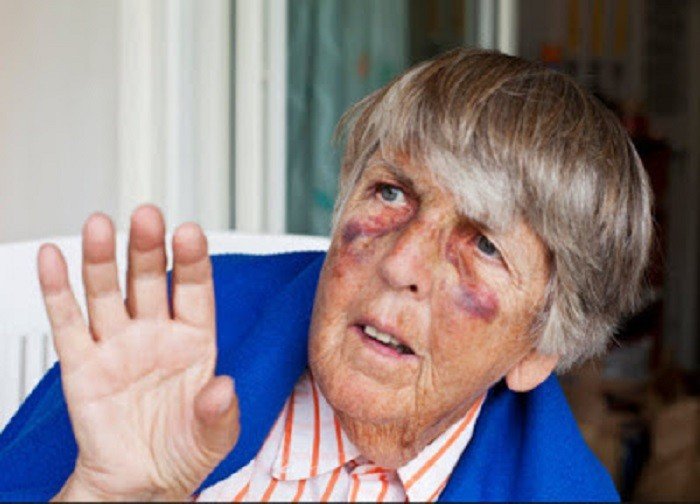 Violência contra idosos: Filhos formam a maioria dos agressores