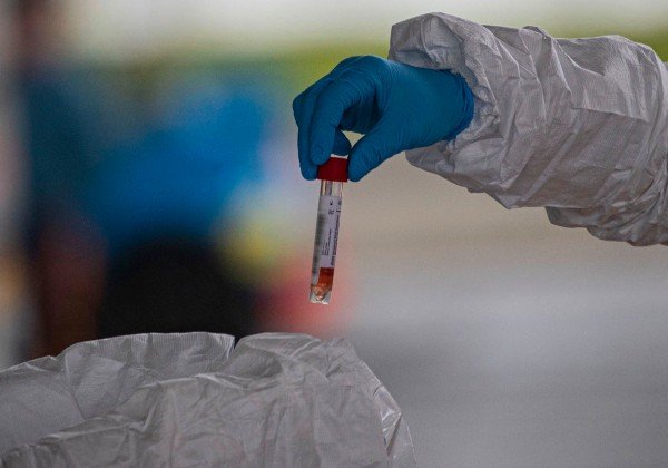 Primeira paciente diagnosticada com coronavírus em DF já está curada