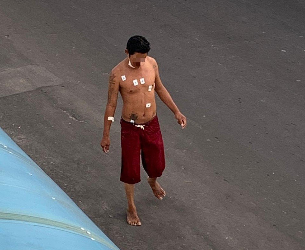 Internado com Covid-19, morador de rua foge de hospital