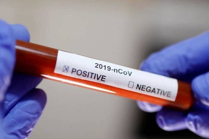 Brasil é o segundo do mundo em casos graves de Covid-19