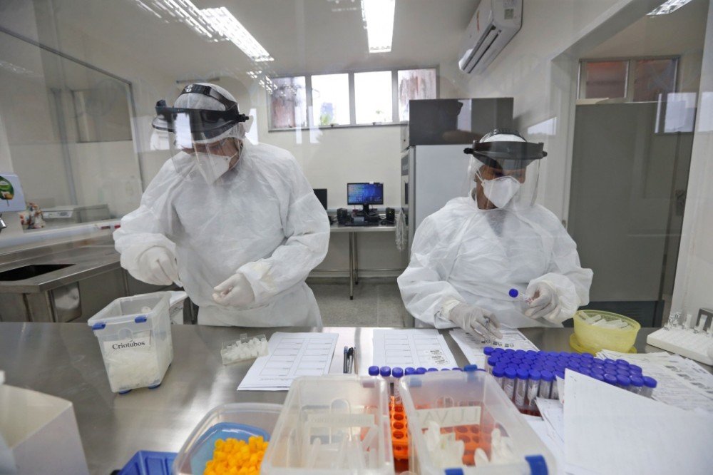Lacen realiza mais de 20 mil testes para detecção de covid-19 e valida laboratórios da rede privada