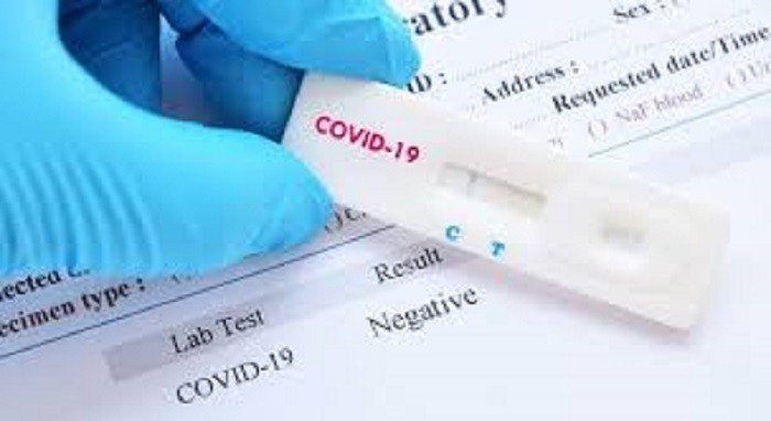Testes rápidos positivos passam a ser aceitos para notificação da Covid-19
