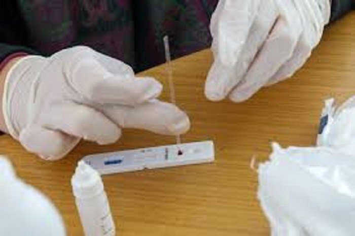 Secretaria da Saúde irá adquirir 50 mil testes rápidos de antígeno para detecção do coronavírus