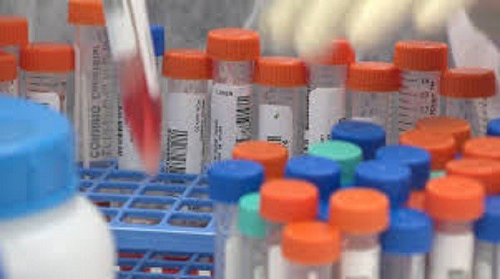 Laboratório que já realizou mais de 1 milhão de testes da Covid-19 no Paraná alerta para aumento de resultados positivos