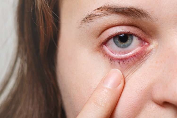 Oftalmologista alerta para doenças nos olhos durante o verão
